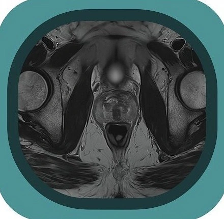 mri male pelvis anatomy icon